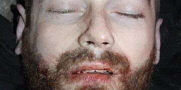 Tragedia w Miłosławiu. Policja chce ustalić tożsamość mężczyzny, który zginął w wypadku