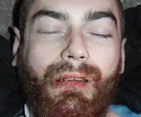 Tragedia w Miłosławiu. Policja chce ustalić tożsamość mężczyzny, który zginął w wypadku